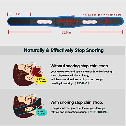 EVSFOEX 2 יחידות אנטי נחר רצועות סנטר למשתמשים CPAP & נמרים בפה נחרת הפחתת רצועת סנטר להפסיק לנחר