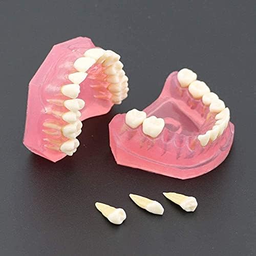 אדם איבר דגם למיילי שיניים סטנדרטי דגם עם נשלף שיניים שיניים מחקר ללמד שיניים דגם רפואי איבר דגם